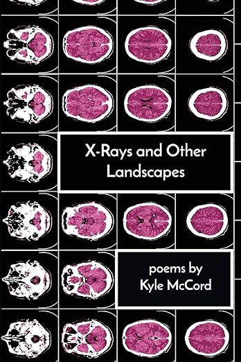 X-Rays and Other Landscapes by Kyle McCord